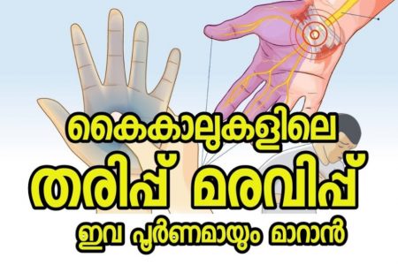 Peripheral neuropathy (often caused by diabetes, B12 deficiency)