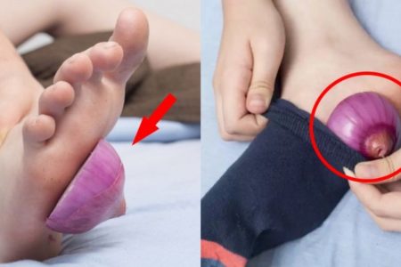 Benefits of Sleeping with Onions on Feet