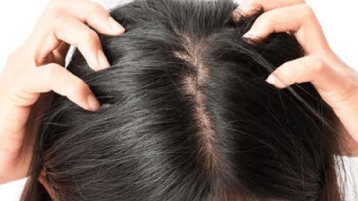 Effective Home Remedies for Removing Lice
